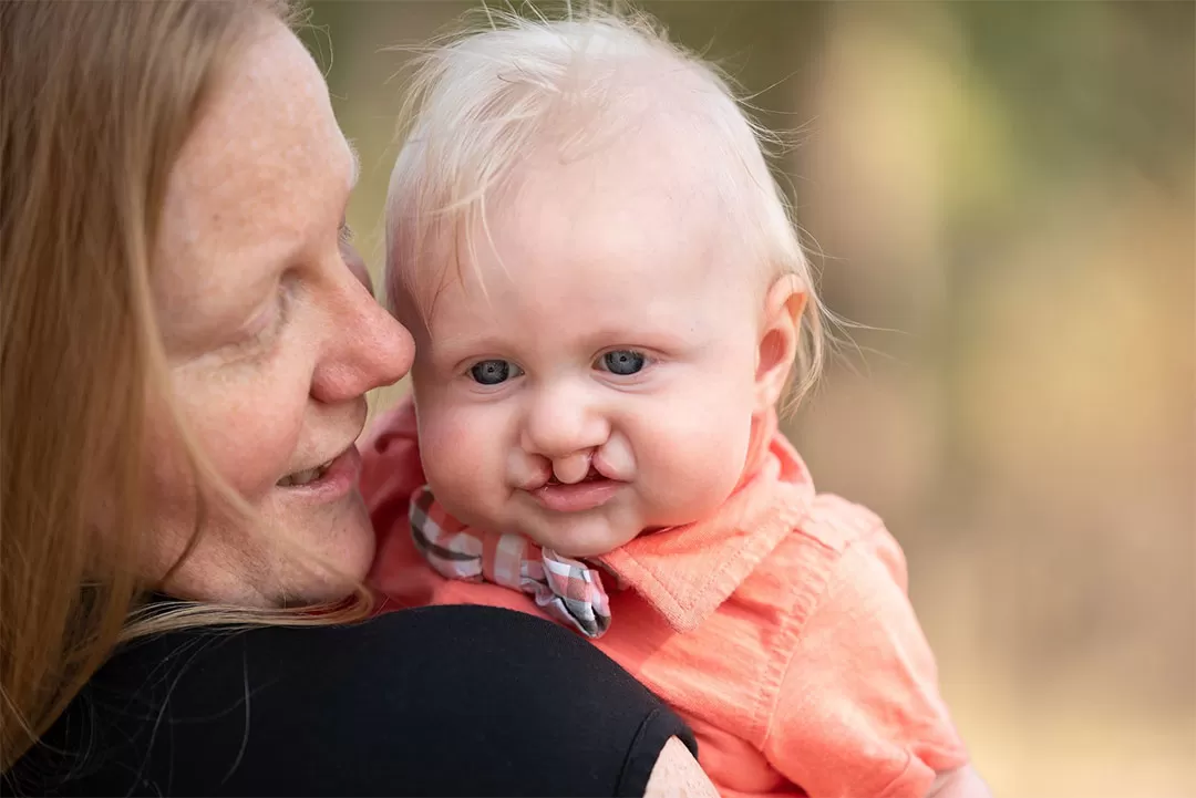 A mom is holding a 7-month old baby and smiling at him. The baby has bright blue eyes, blonde hair, a bilateral cleft lip, and an orange shirt with a bow tie. He's smiling and looking below the camera. 