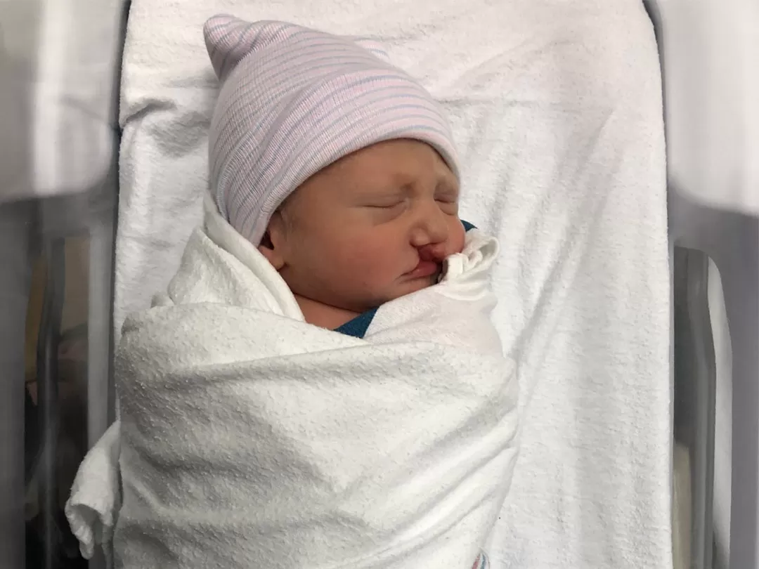 A brand new baby boy lays sleeping peacefully in a hospital toque and crib. He has a cleft lip. 